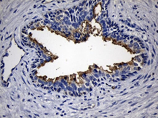 PIKFYVE / PIP5K Antibody (clone OTI1D2, Carrier-free)