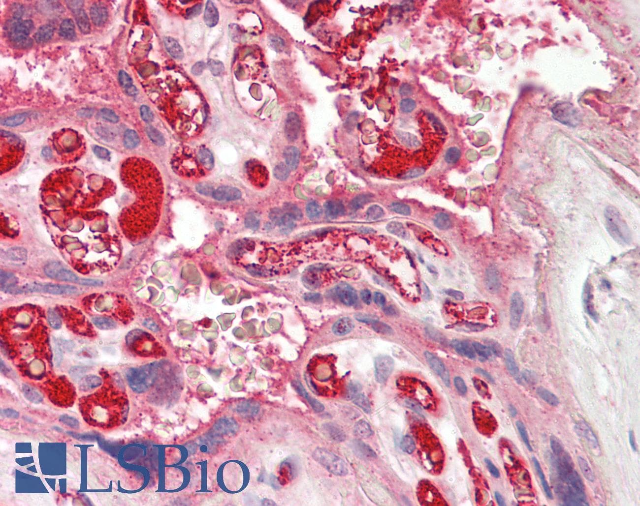 IHC-plus™ Polyclonal Rabbit anti-Human CHML Antibody (aa128-177, IHC, WB)