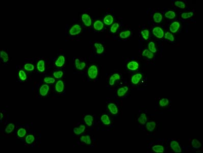 HIST1H4I Antibody