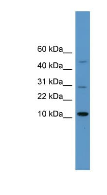 HMGIY / HMGA1 Antibody (N-Terminus)