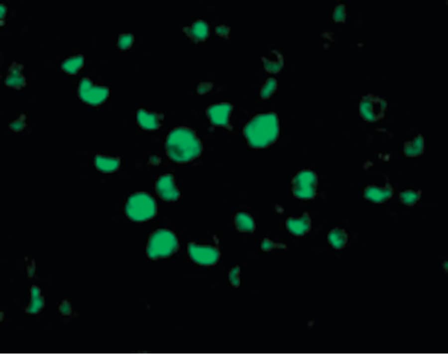 APAF1 / APAF-1 Antibody