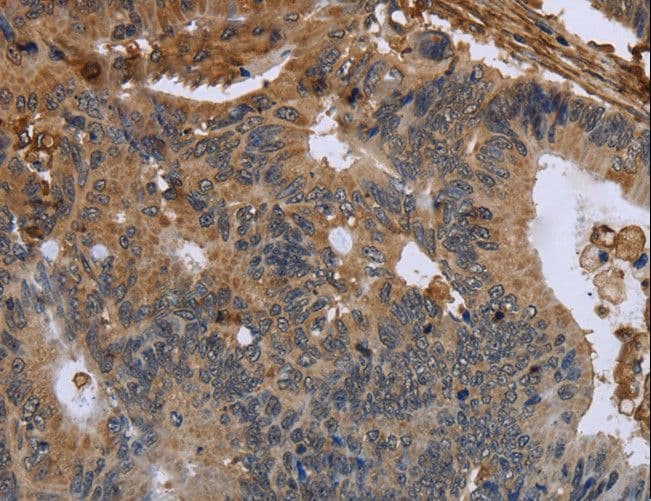 FLNA / Filamin A Antibody
