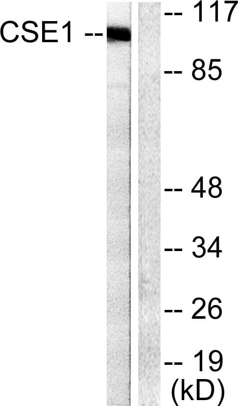 Polyclonal Rabbit anti-Human CSE1L Antibody (IHC, IF, WB)