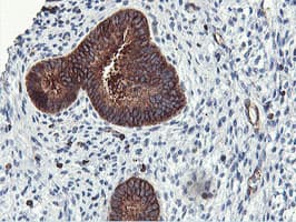 PFKP Antibody (clone OTI3G8, Carrier-free)