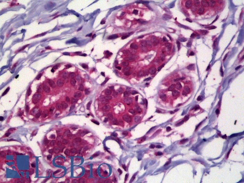 IHC-plus™ ACHE / Acetylcholinesterase Antibody