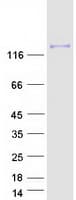 Human HEPH / Hephaestin Protein (Recombinant Myc-DDK (Flag))
