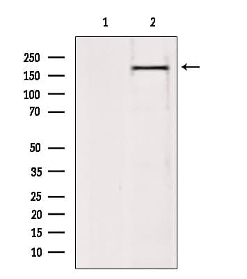 BAZ2A / TIP5 Antibody