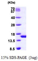 Human PHPT1 Protein (Recombinant His)