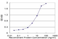IHC-plus™ CALCR / Calcitonin Receptor Antibody (clone 2F7)