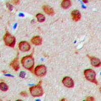 TUSC2 / FUS1 Antibody (Internal)