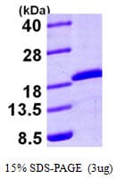 Human UBE2A Protein (Recombinant His)