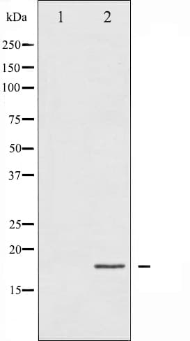 Polyclonal Rabbit anti-Human EIF4EBP1 / 4EBP1 Antibody (phospho-Thr45, IHC, IF, WB)