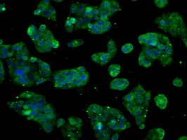 CYP2E1 Antibody (clone OTI5F11)