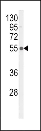 Polyclonal Rabbit anti-Human TNFRSF1A / TNFR1 Antibody (phospho-Ser274, IHC, WB)