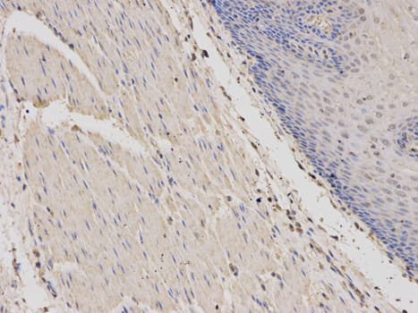 IHC-plus™ Polyclonal Rabbit anti-Human PRKAR1A Antibody (IHC, IF, WB)