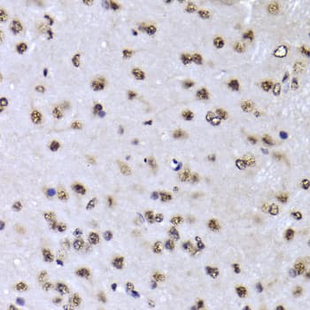 EFTUD2 Antibody