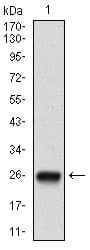 IHC-plus™ Monoclonal Mouse anti-Human NT5E / eNT / CD73 Antibody (clone 4G6B10, aa30-250, IHC, WB)