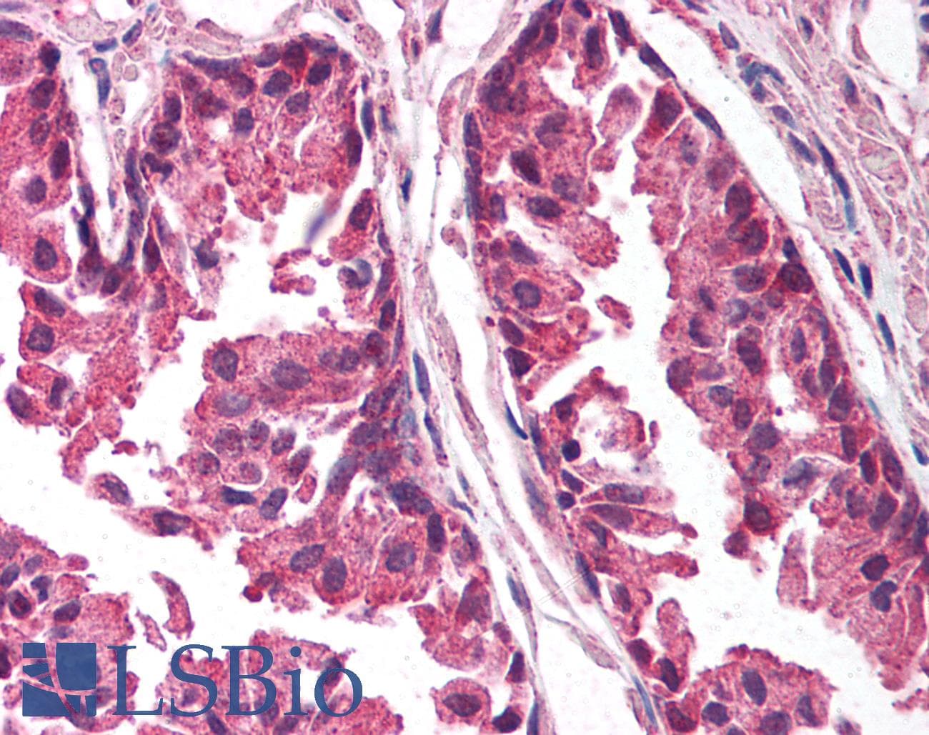 IHC-plus™ Polyclonal Rabbit anti-Human TICAM1 / TRIF Antibody (IHC, IF, WB)