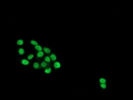 PathPlus™ HES1 / HES-1 Antibody (clone OTI1B5)