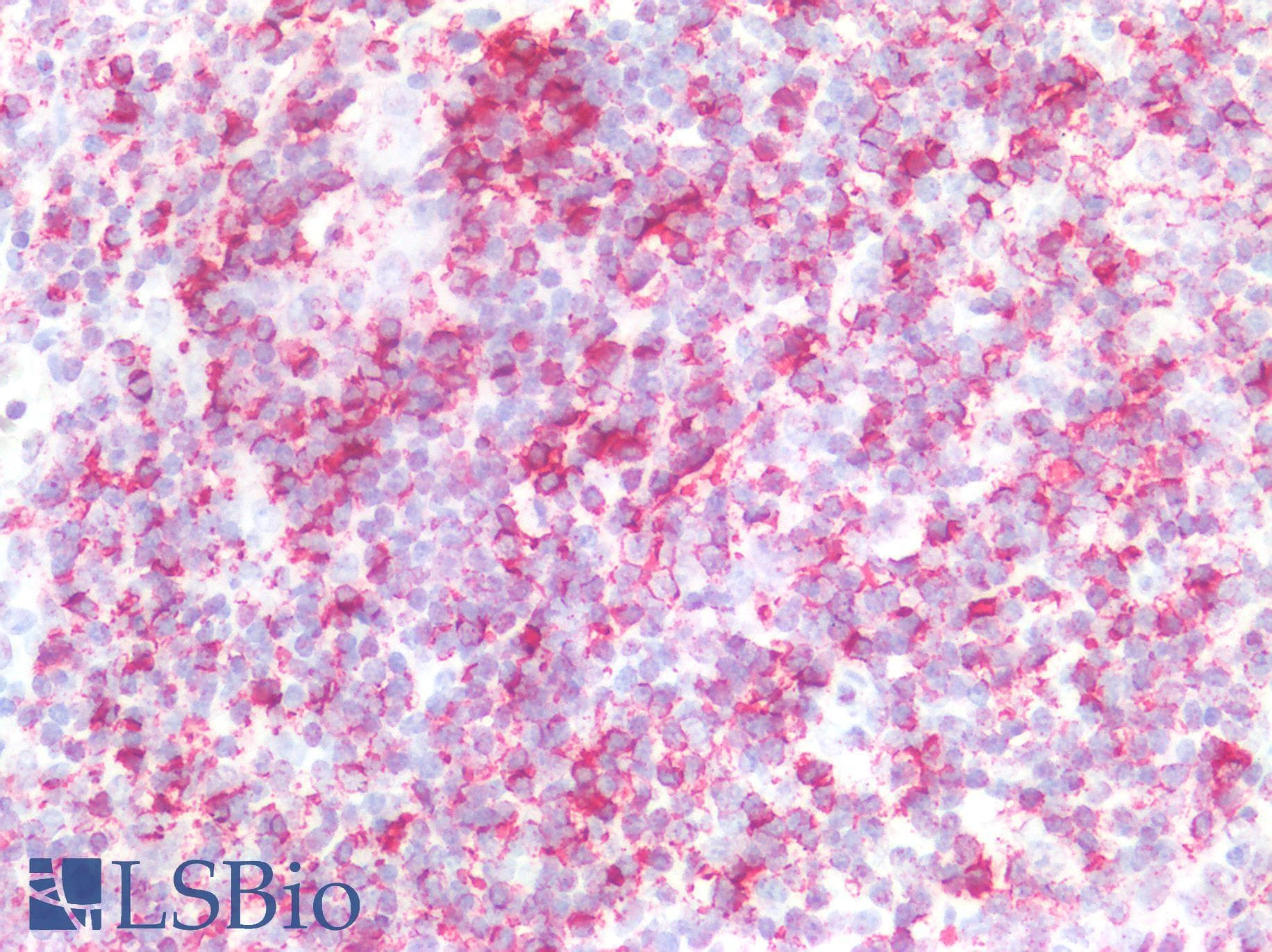 PathPlus™ CD45RO Antibody (clone 4KB5)
