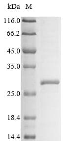 Mouse Klra3 / Ly49c Protein (Recombinant 6His, N-terminus)