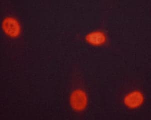 CHEK1 / CHK1 Antibody (phospho-Ser301)
