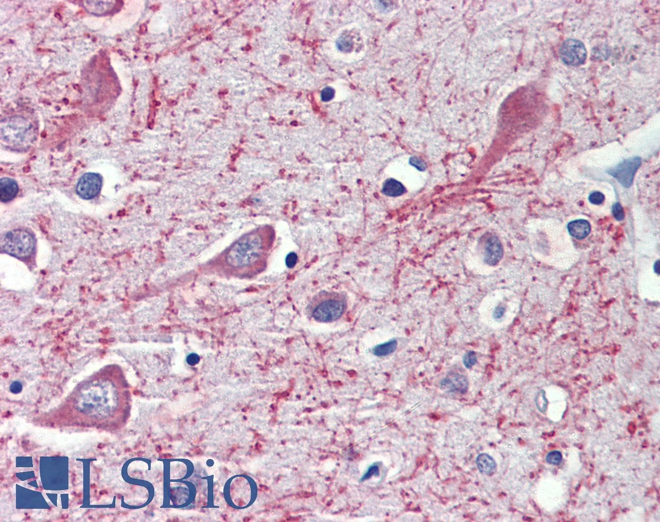 IHC-plus™ CYP26 / CYP26A1 Antibody (aa485-496)