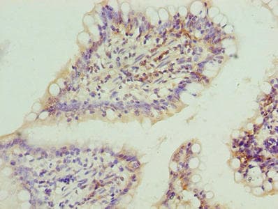 Polyclonal Rabbit anti-Human FAR2 Antibody (IHC)