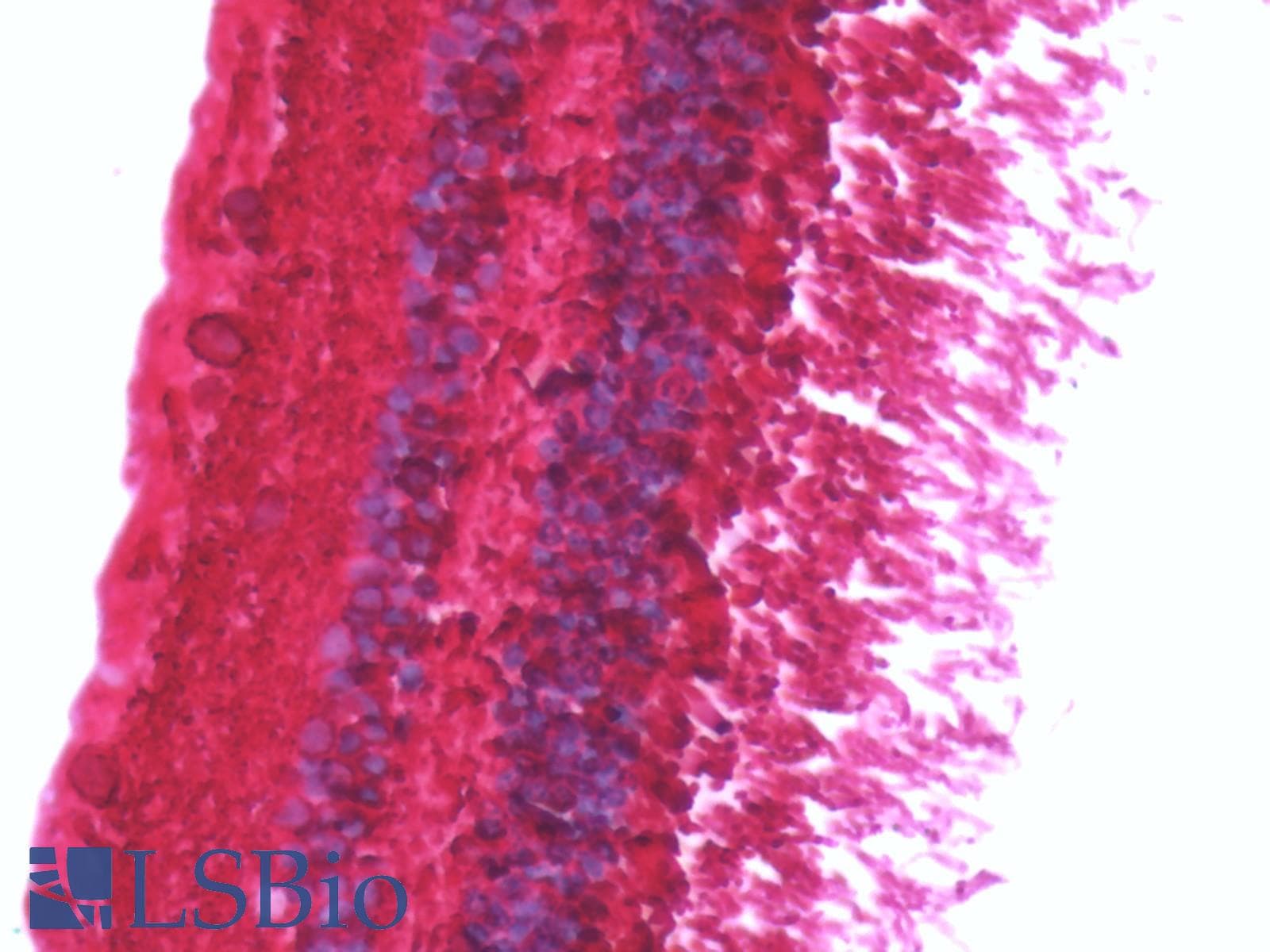 IHC-plus™ Polyclonal Rabbit anti-Human ARR3 / Cone Arrestin Antibody (IHC, IF, WB)