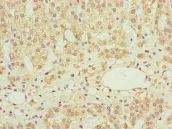 Polyclonal Rabbit anti-Human NDUFS6 Antibody (IHC, WB)
