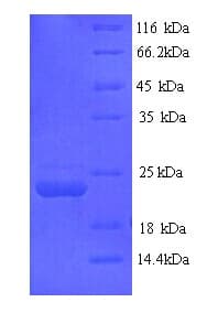 Mouse LILRB3 Protein (Recombinant His)