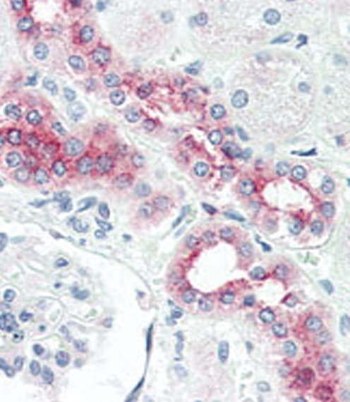 Polyclonal Rabbit anti-Human BMPR2 Antibody (aa28-59, IHC, WB)