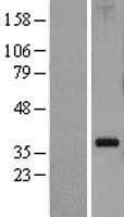 RPL5 / Ribosomal Protein L5 (Over-Expression Lysate Myc-DDK (Flag))