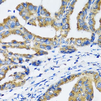 NFKB1 / NF-Kappa-B Antibody
