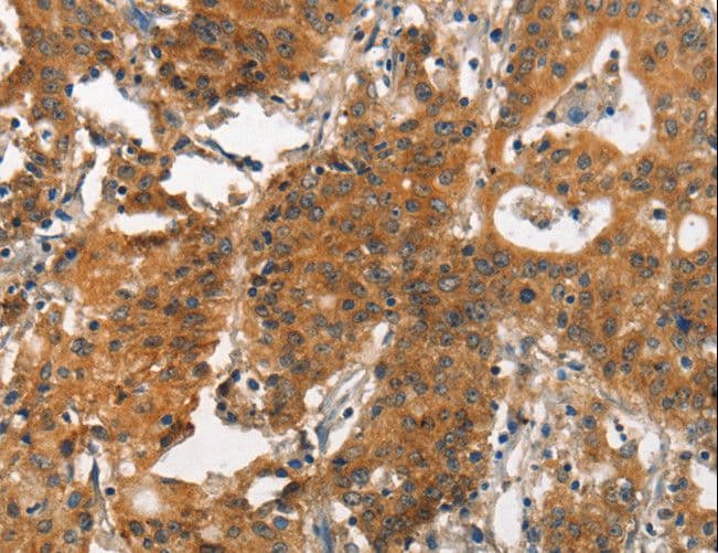 ITGA2 / CD49b Antibody