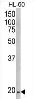 NDUFS4 Antibody (aa131-160)