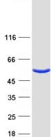 Human VAT1L Protein (Recombinant Myc-DDK (Flag))