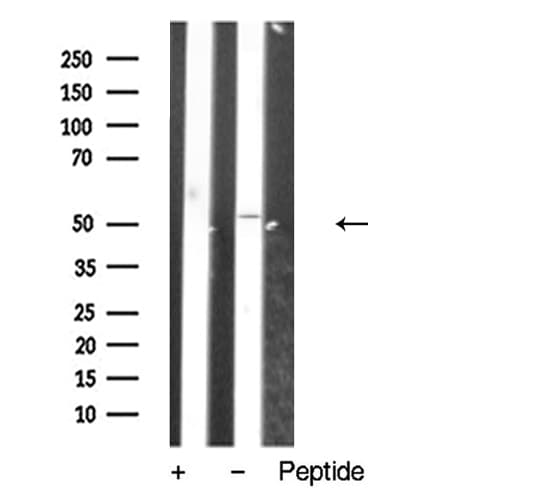 VPAC2 / VIPR2 Antibody