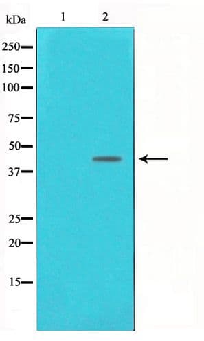 POLB / DNA Polymerase Beta Antibody
