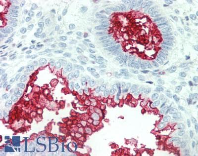 IHC-plus™ SLC34A2 / NaPi-2b Antibody (C-Terminus)