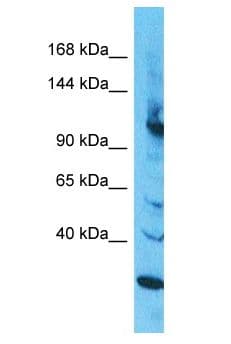 Polyclonal Rabbit anti-Human INTS2 / INT2 Antibody (aa1132-1181, WB)