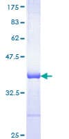 Human HSPA1B Protein (Recombinant GST, N-terminus)