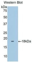 Human FNDC5 / Irisin Protein (Recombinant His, N-Terminal)