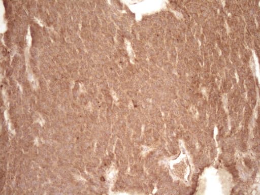 BCL2 / Bcl-2 Antibody (clone OTI9D3)