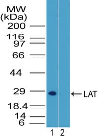 IHC-plus™ LAT Antibody (aa70-120)