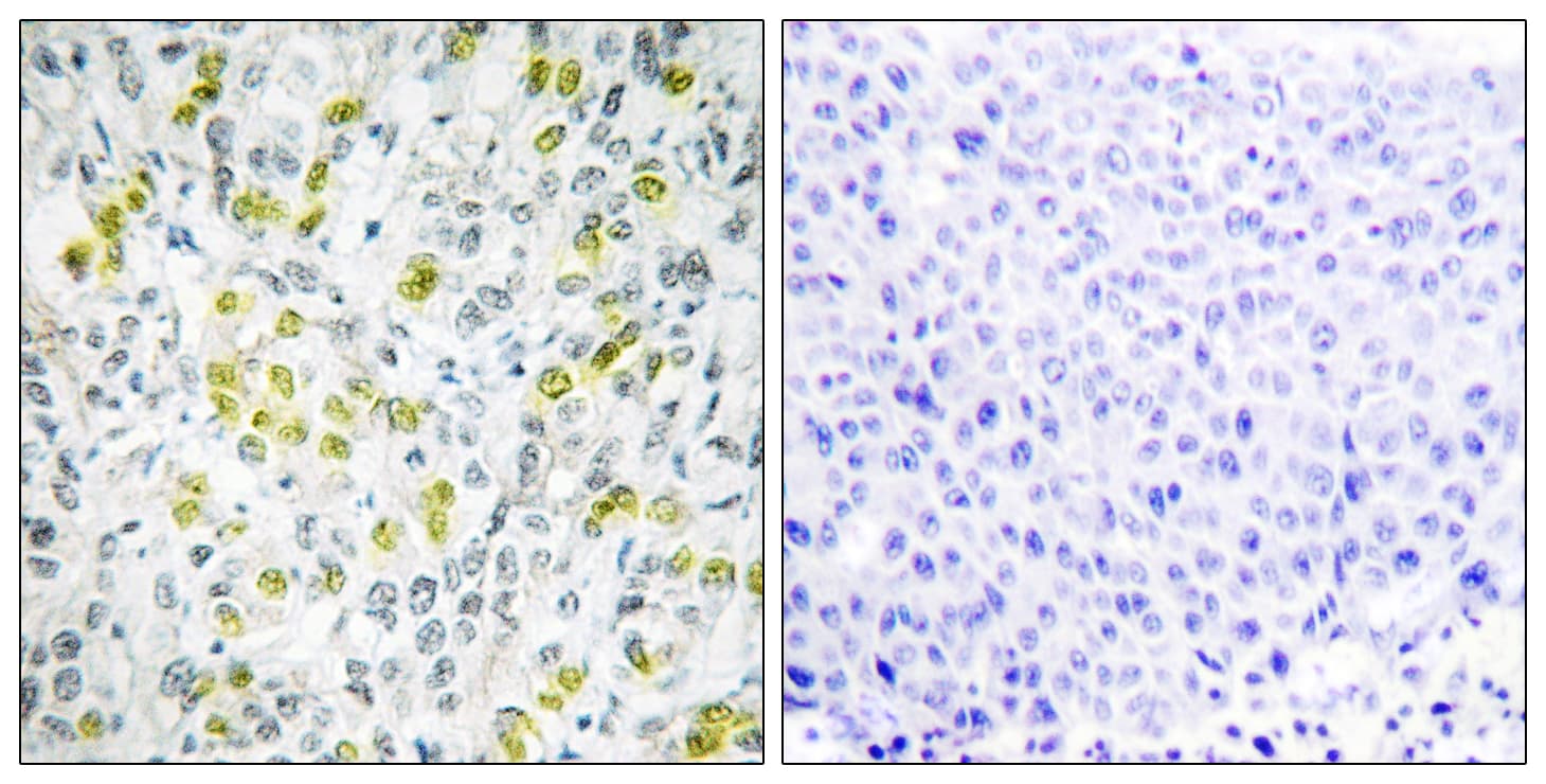 CHD4 Antibody (aa571-620)