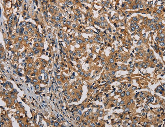 PLIN3 / M6PRBP1 / TIP47 Antibody
