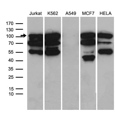 TCF12 / HEB Antibody (clone OTI3C11)