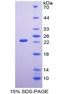 Mouse FGF6 Protein (Recombinant His-T7)