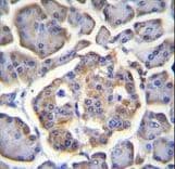 BTBD17 Antibody (aa411-440)